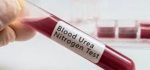 آیا تا به حال آزمایش نیتروژن اوره خون داشته اید؟
