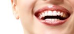 بهترین روش سفید کردن دندان‌ ها کدام روش است؟ + عکس